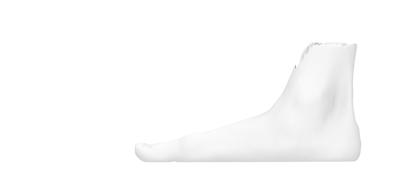 Patologii in care pot fi utilizare ortezele pentru picior